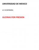 Ulceras por presion