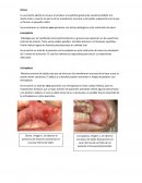 Ulceras, lueucoplasias y eritroplasias