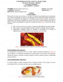 LIPIDOS Y COLESTEROL