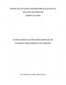 Alteraciones electrocardiograficas de diversos padecimientos de corazon