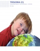 Trisomia 21