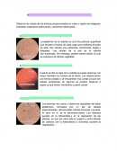 Observación de células vegetales