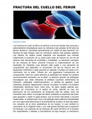 Fractura del cuello del femur