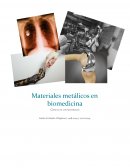 Materiales metálicos en biomedicina