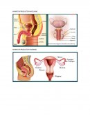 Enfermedades de Transmisión Sexual