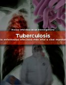 Ensayo sobre la tuberculosis