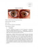 Análisis de Iridiologia