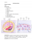 ARTERIOESCLEROSIS ÓRGANO O SISTEMA: