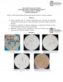 Tinción diferencial para bacterias ácido-alcohol resistentes y tinciones especiales