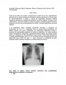 Farmacología Caso clínico