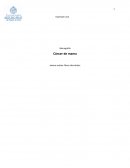 Monografía. Cáncer de mama