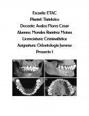 Sistema de Numeracion Dental