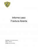 Fractura Abierta