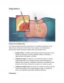 Examen de la médula ósea