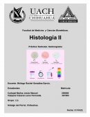 HISTOLOGÍA SEMINOGRAMA