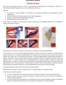TECNICA DE CEPILLADO DE BASS
