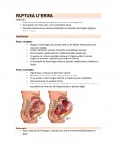 Ruptura uterina