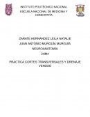 Practica de cortes transversales y drenaje venoso