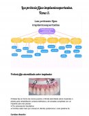 Las prótesis fijas implantosoportadas