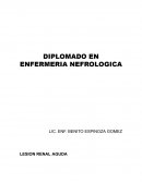 Lesión renal aguda