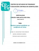 Tecnica Gow Gates modificada