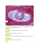 ¿Cuál de las siguientes hormonas estará ausente?
