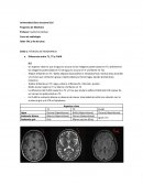 Taller TAC y Rx de tórax