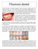 Fluorosis dental