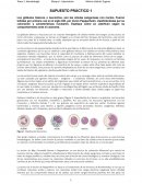 Explica cómo se clasifican los leucocitos en función del colorante