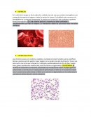 Morfologia de la sangre
