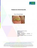 Investigación procedimientos de podología avanzada