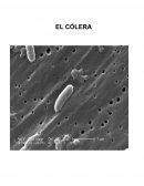 El Cólera. La bacteria “Vibrio Cholerae”