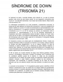 Síndrome de Down (trisomía 21)