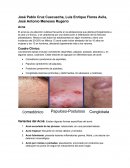 Resumen acne, Cuadro clínico